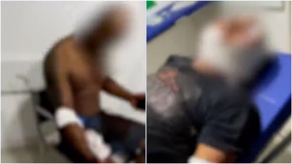 Ataque de pitbulls deixa três pessoas feridas em Paço do Lumiar
