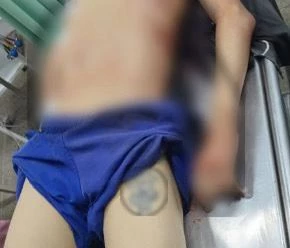 Adolescente, de 14 anos, é morto a tiros por 10 criminosos em São José de Ribamar