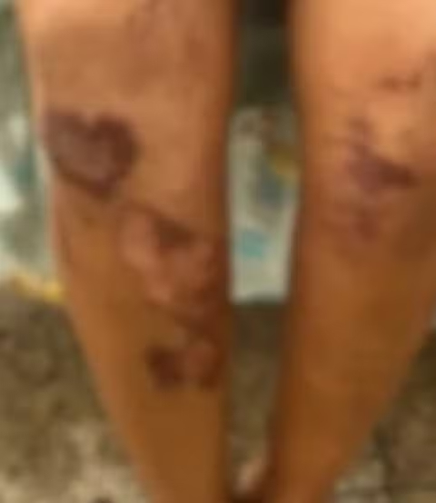 Mulher é agredida e arrastada por homem que tentou estuprá-la no Maranhão