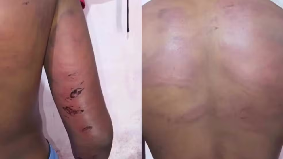 Policial é preso por suspeita de torturar adolescente no Maranhão; vítima namorava com enteada de PM