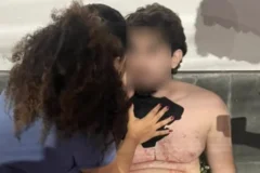 Jovem é baleado em tentativa de assalto ao sair de academia em São Luís
