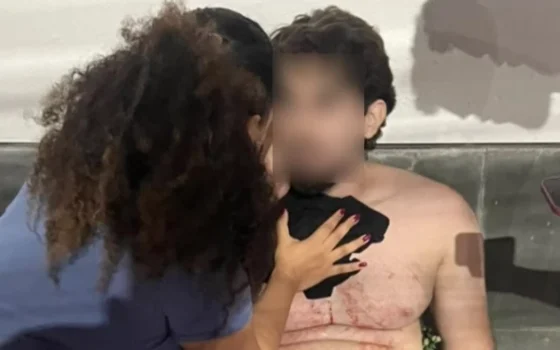 Jovem é baleado em tentativa de assalto ao sair de academia em São Luís