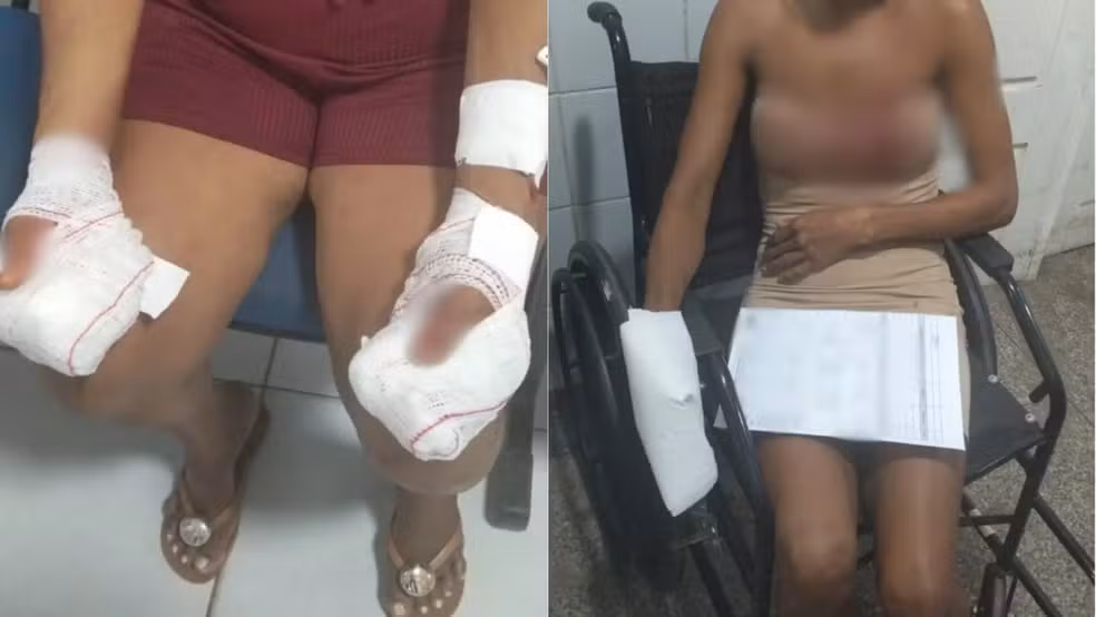 Homem é preso suspeito de agredir a mãe e a própria namorada em Codó; uma das vítimas perdeu alguns dedos